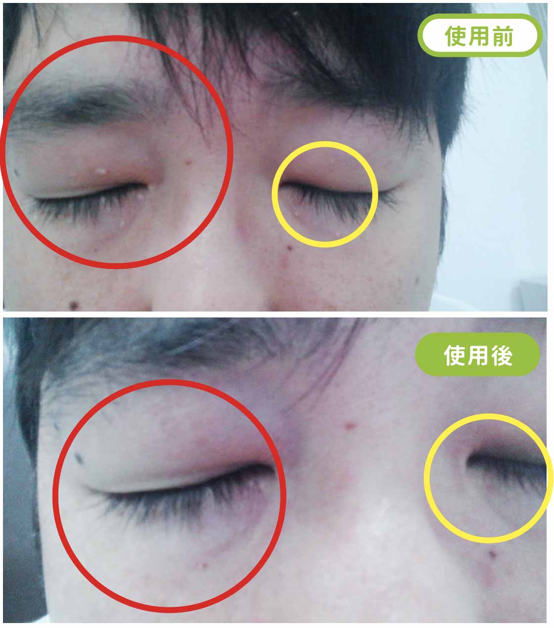 俏樂斯 曾沛慈 小綠餅 美白 抗皺 幼美肌 全方位保濕水凝霜 肉芽 顆粒 脂肪粒 醫美 電燒 除肉芽 淡化斑點 保濕 凝膠 沖繩 薏米 巴鈺