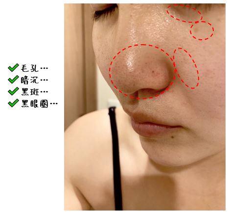 毛孔 暗沉 黑眼圈