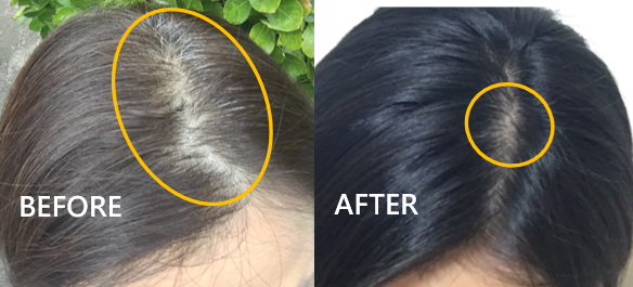 多立寶 東森 多髮寶 生髮 養髮 健髮 育髮 掉髮 CSC 落髮 一袋女王 生髮專家 禿頭