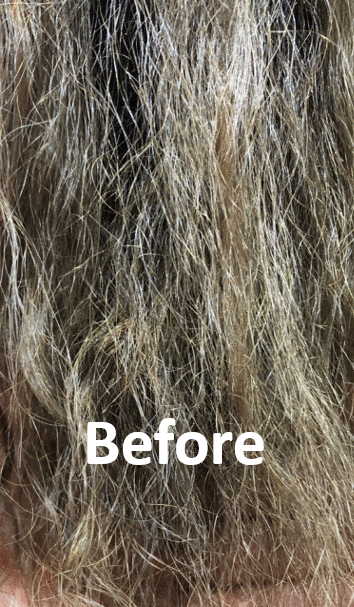 多立寶 東森 多髮寶 生髮 養髮 健髮 育髮 掉髮 CSC 落髮 一袋女王 生髮專家 禿頭