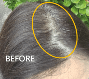 多立寶 東森 多髮寶 生髮 養髮 健髮 育髮 掉髮 CSC 落髮 一袋女王 生髮專家 禿頭